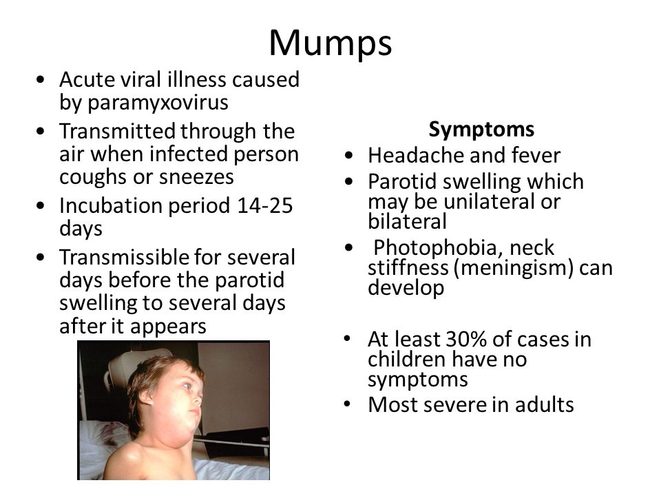 characteristics treatment and prevention of mumps essay characteristics treatment and prevention of mumps essay
