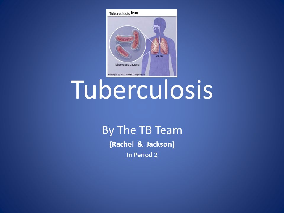 pulmonary tuberculosis essay pulmonary tuberculosis essay