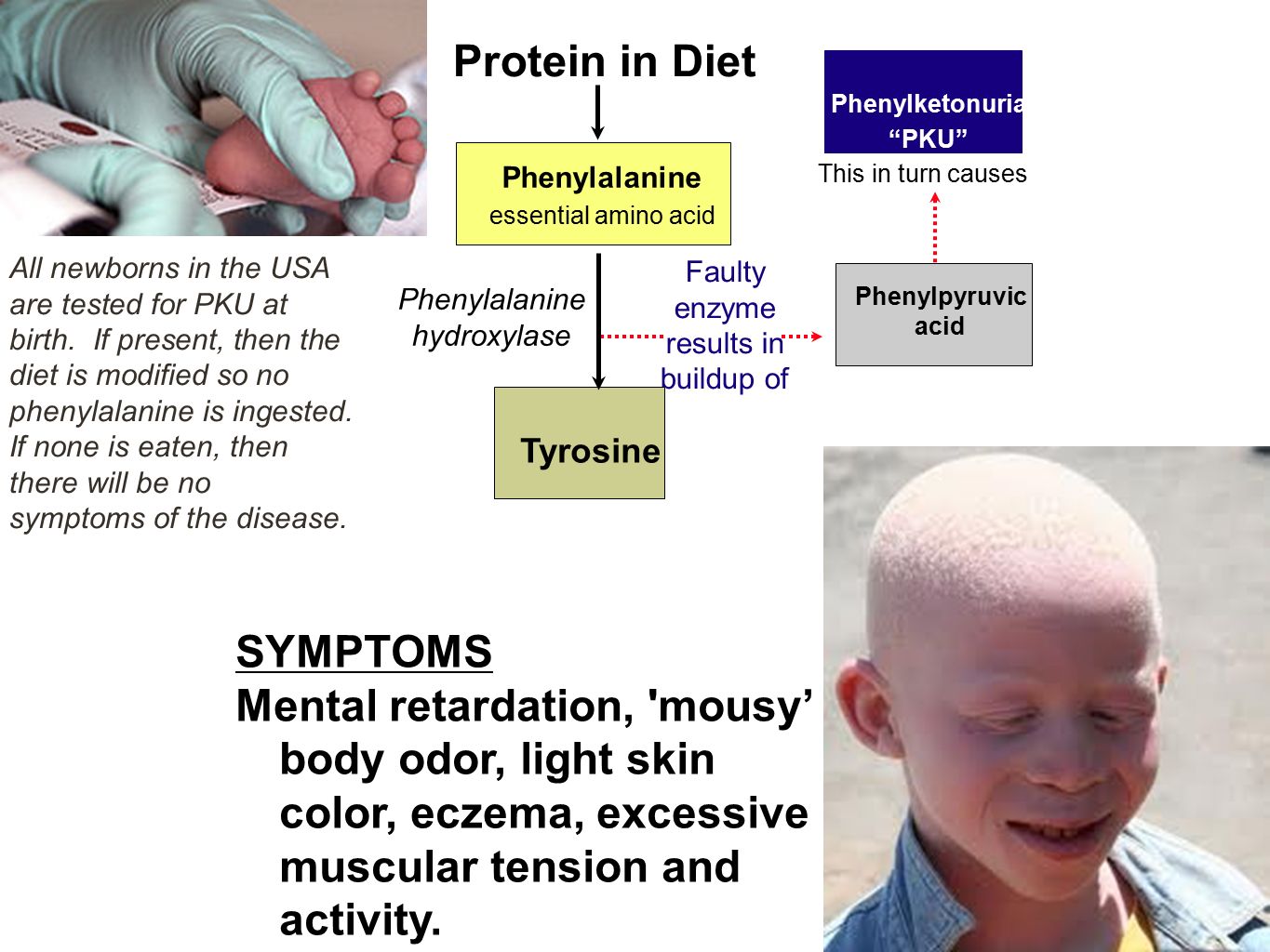 Metabolism Metabolism Is “the Chemical Reactions Of Life; All - 1365x1024 - jpeg Phenylketonuria Symptoms