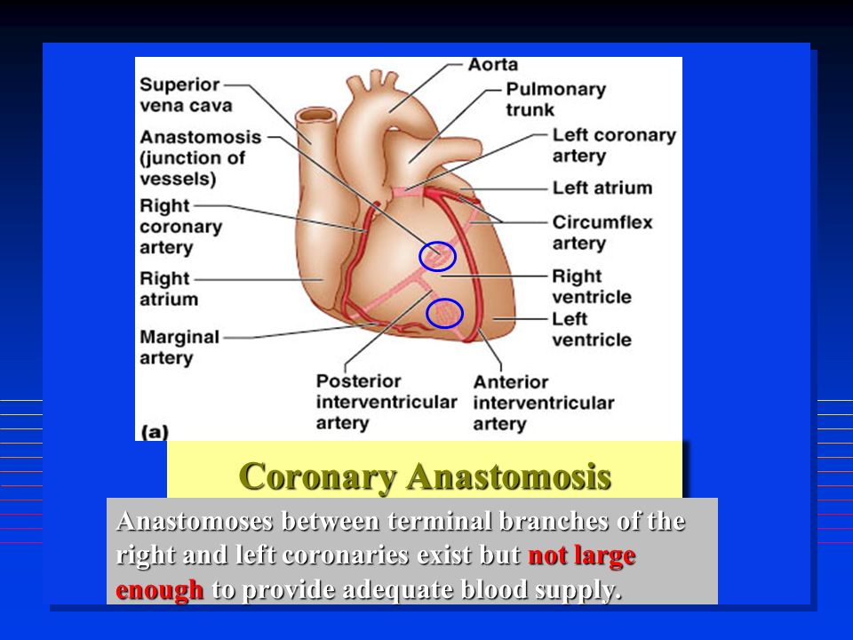 Coronary Anastomosis Anastomoses between terminal branches of the right and left coronaries exist but not large enough to provide adequate blood supply.