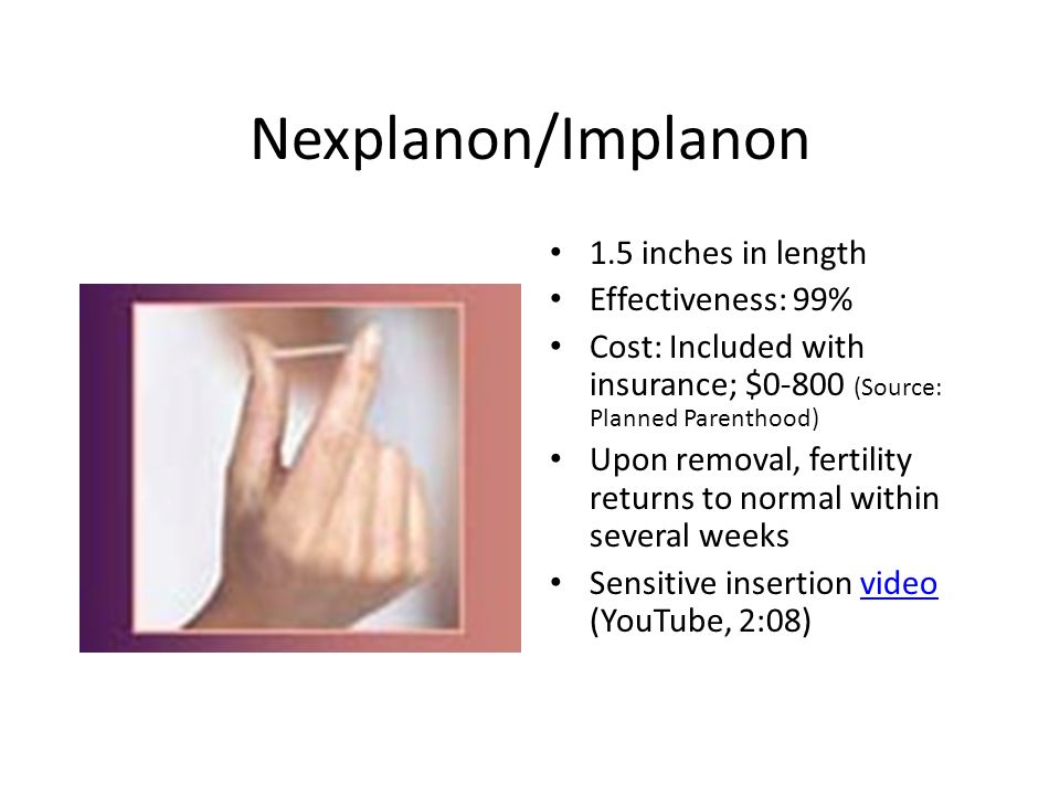 plan parenthood birth control implant