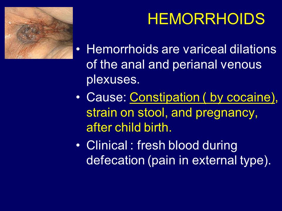 Blood in stool and pregnancy