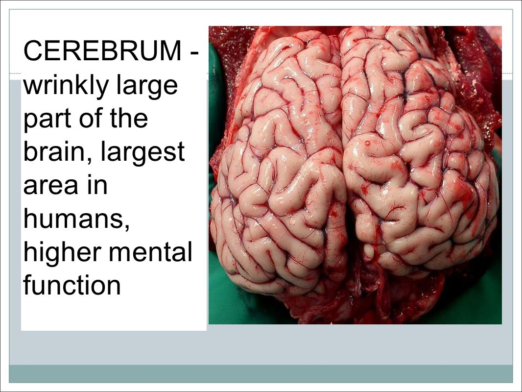 CEREBRUM - wrinkly large part of the brain, largest area in humans, higher mental function