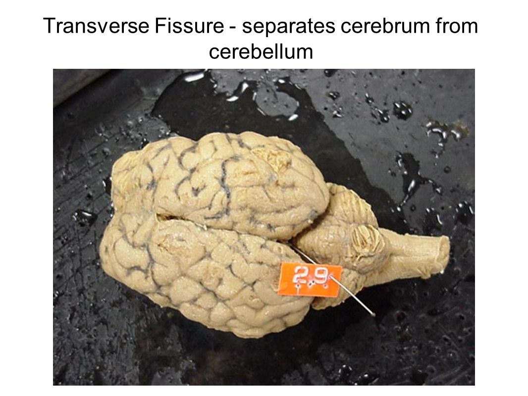 Transverse Fissure - separates cerebrum from cerebellum