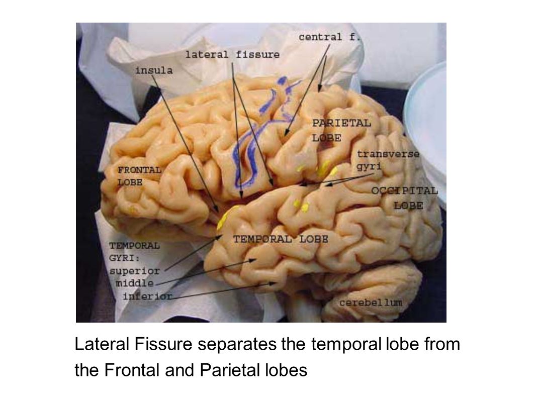 Lateral Fissure separates the temporal lobe from the Frontal and Parietal lobes