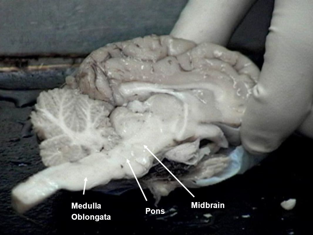 Midbrain Medulla Oblongata Pons