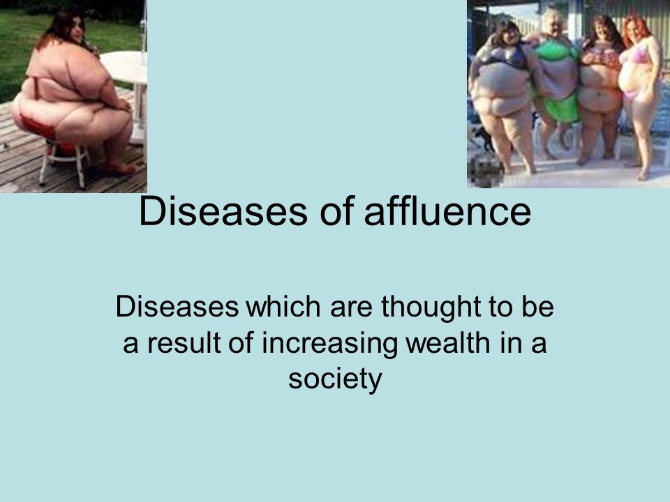 diseases of affluence diseases which are thought to be a result of which is a disease of affluence