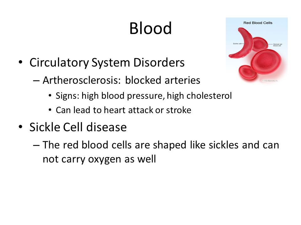 Blood Circulatory System Disorders – Artherosclerosis: blocked arteries Signs: high blood pressure, high cholesterol Can lead to heart attack or stroke Sickle Cell disease – The red blood cells are shaped like sickles and can not carry oxygen as well