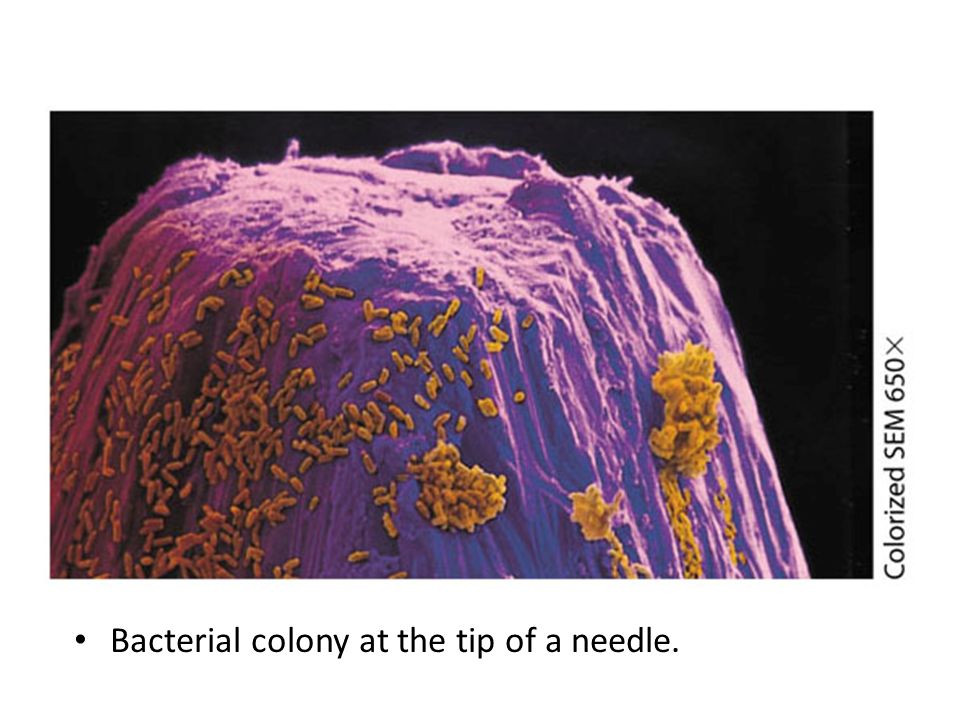 Bacterial colony at the tip of a needle.