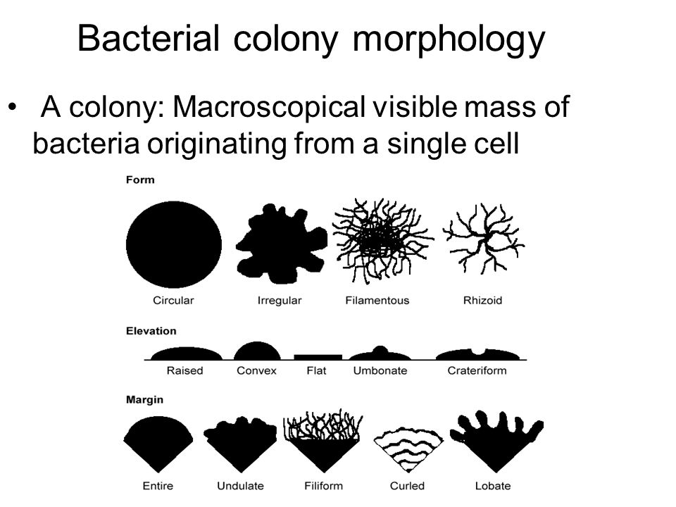 bacterial morphology lab reports Lab report of microbiology download the bacterial suspension is pour on the agar, and then spread evenly over the surface with a sterile glass rod. bacterial morphology lab reports Lab report of microbiology download the bacterial suspension is pour on the agar, and then spread evenly over the surface with a sterile glass rod.