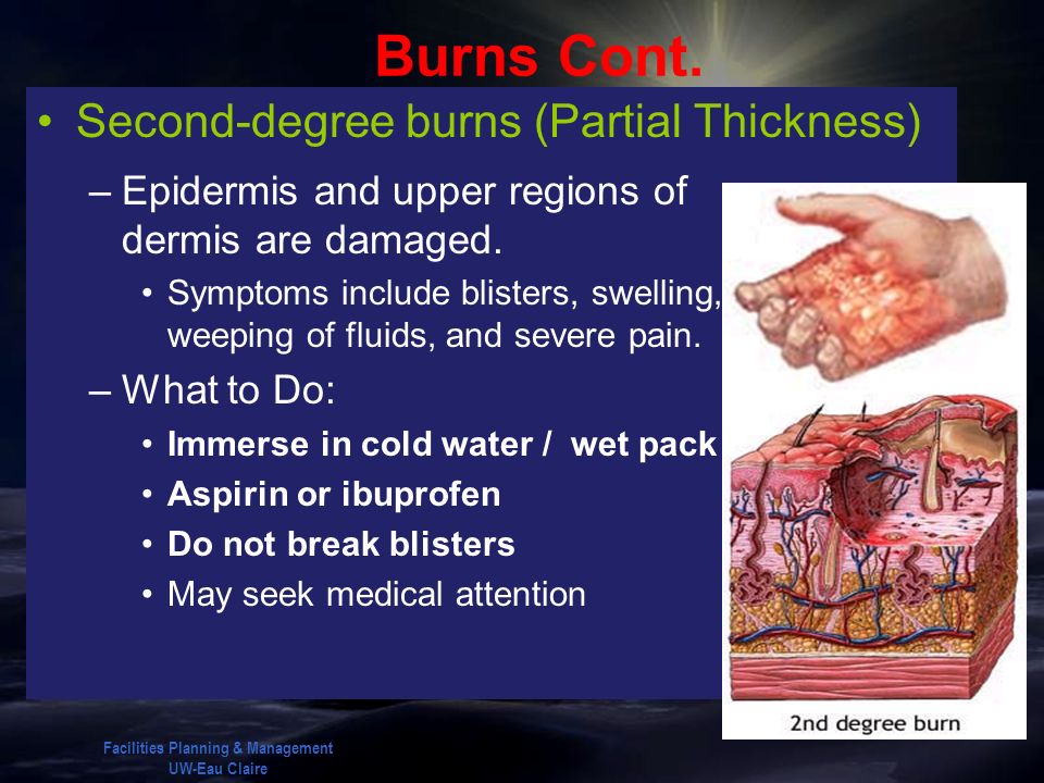 sudden illness Red cross first aid sudden illness learn with flashcards, games, and more — for free. sudden illness Red cross first aid sudden illness learn with flashcards, games, and more — for free.