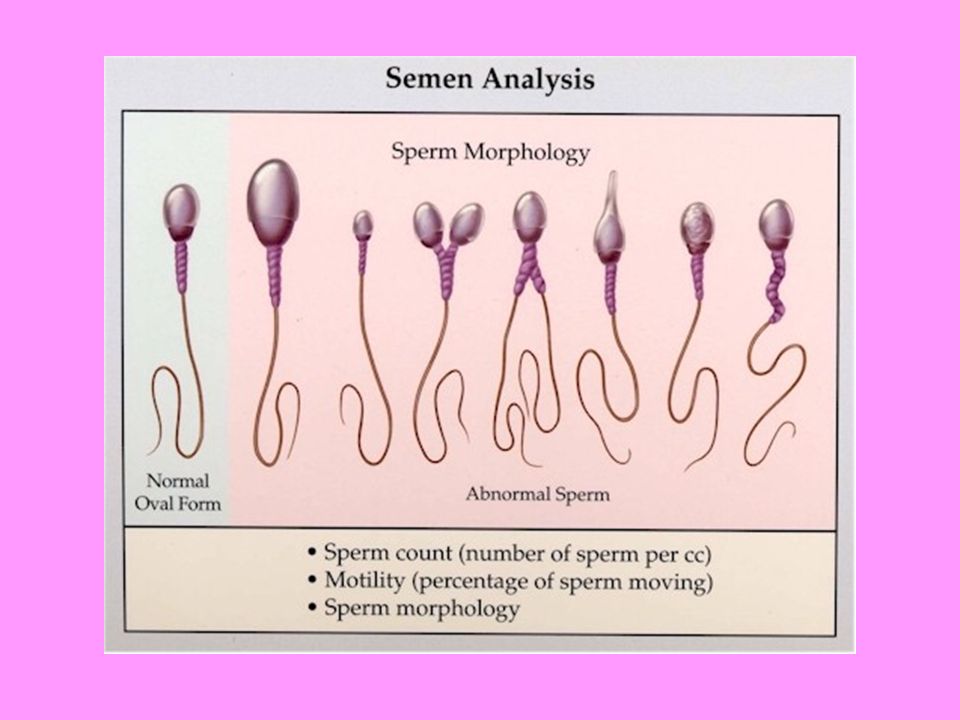 Normal male sperm counts