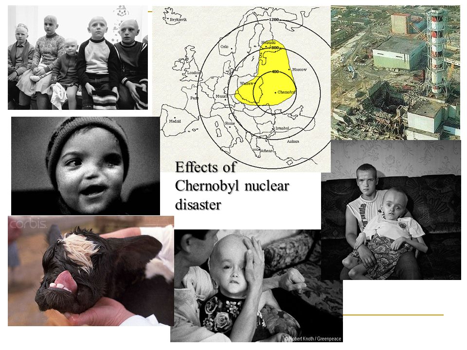 Effects of Chernobyl nuclear disaster