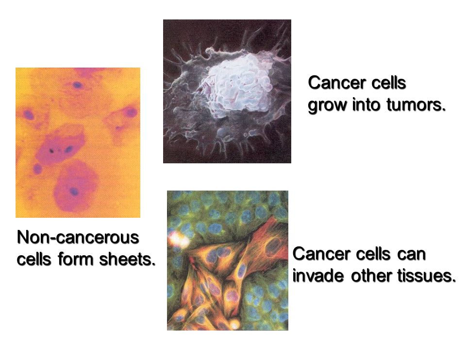 the cell cycle and cancer how do we define cancer cancer is 1 a how do cancer form