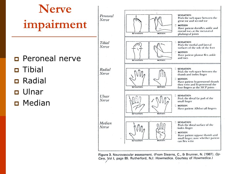 nursing care of the adult system with musculoskeletal stressors neurovascular assessment