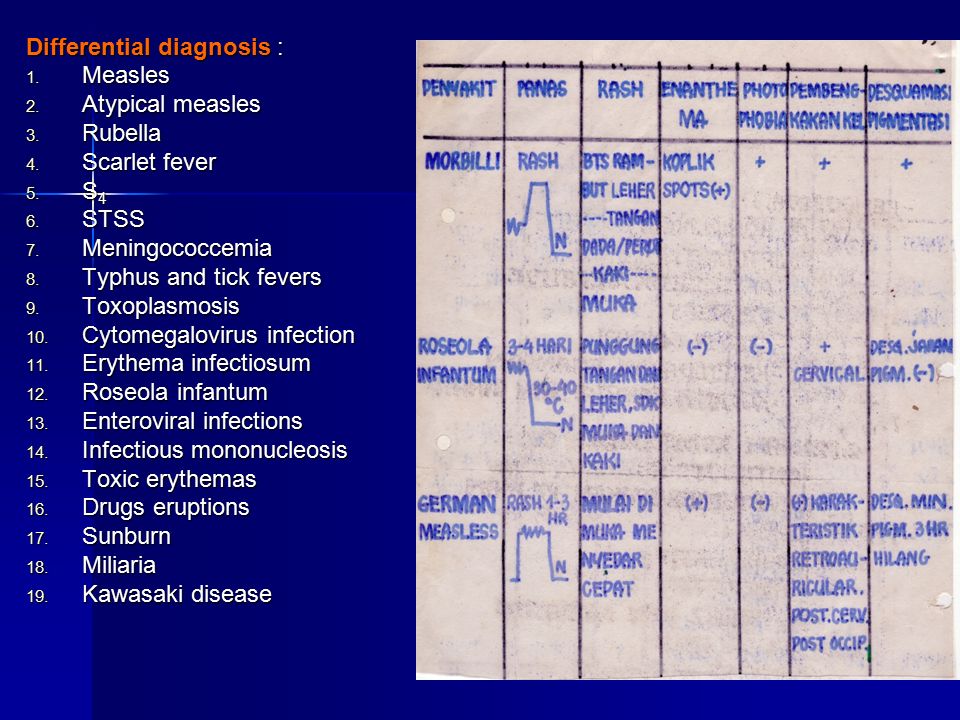 16 Differential diagnosis : 1. Measles 2. Atypical measles 3.