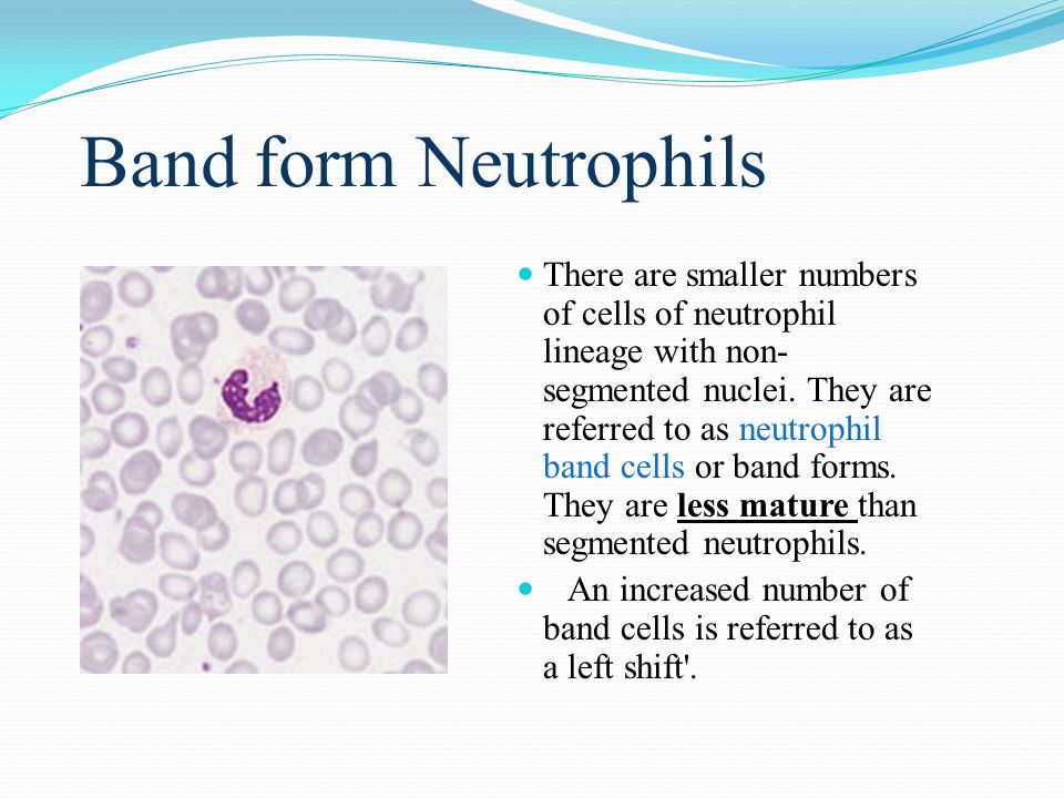 an in depth look at leukocytes and the leukocyte deferential count Blood collection and analysis differential white blood cell count procedure: 1) deficiencies of leukocytes are referred to as leukopenia. an in depth look at leukocytes and the leukocyte deferential count Blood collection and analysis differential white blood cell count procedure: 1) deficiencies of leukocytes are referred to as leukopenia.