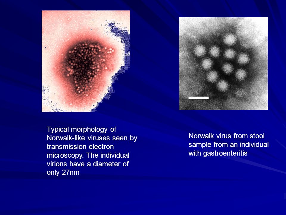 norwalk virus norwalk virus