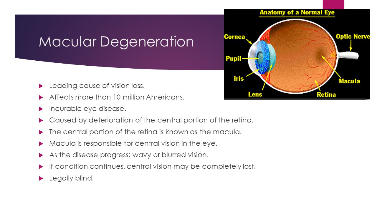 Effects Of Levitra On Macular Degeneration