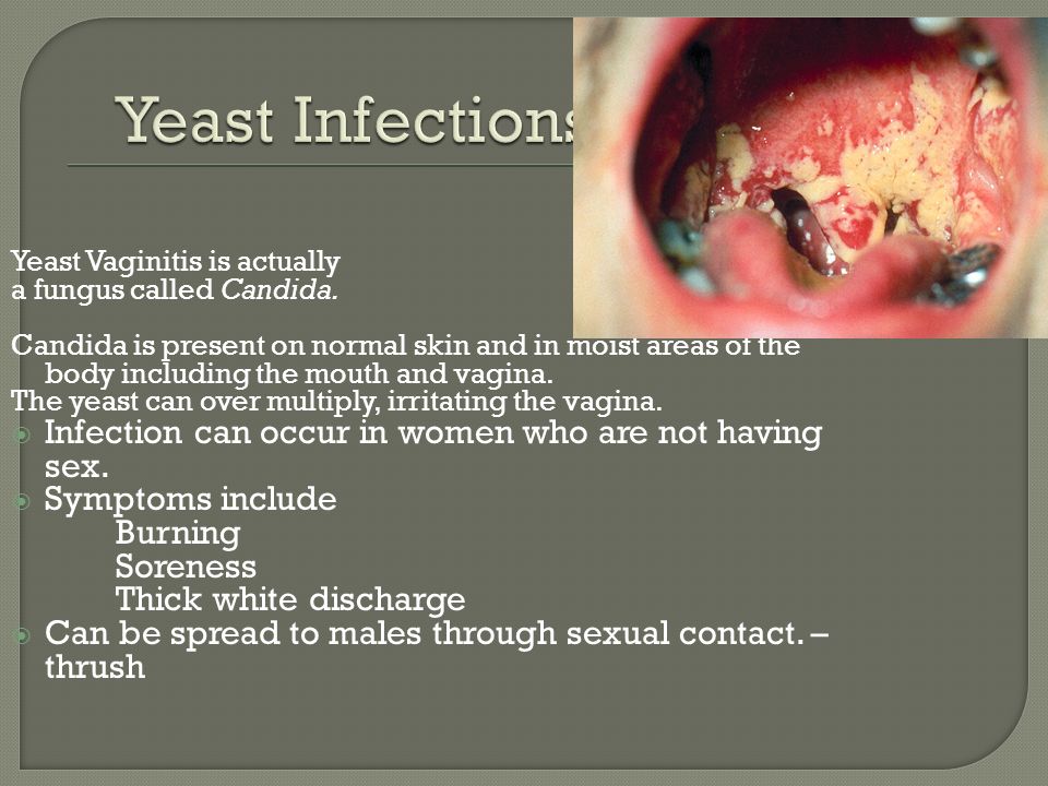Thick white discharge during sex — photo 5