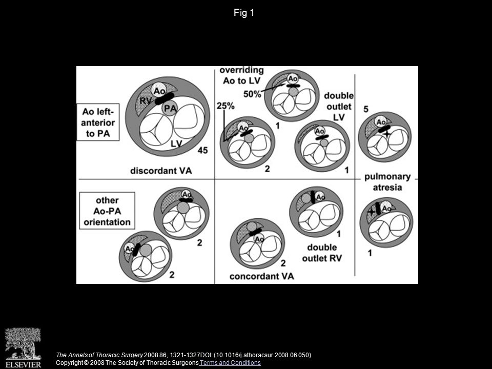 Fig 1 The Annals of Thoracic Surgery , DOI: ( /j.athoracsur ) Copyright © 2008 The Society of Thoracic Surgeons Terms and Conditions Terms and Conditions