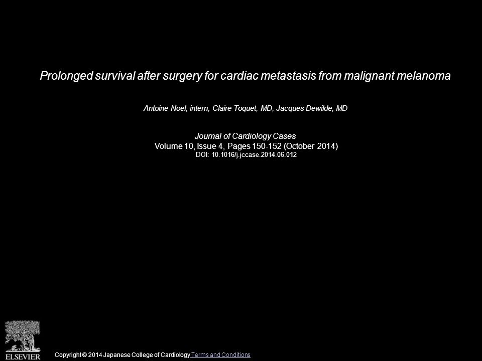 Prolonged survival after surgery for cardiac metastasis from malignant melanoma Antoine Noel, intern, Claire Toquet, MD, Jacques Dewilde, MD Journal of Cardiology Cases Volume 10, Issue 4, Pages (October 2014) DOI: /j.jccase Copyright © 2014 Japanese College of Cardiology Terms and Conditions Terms and Conditions