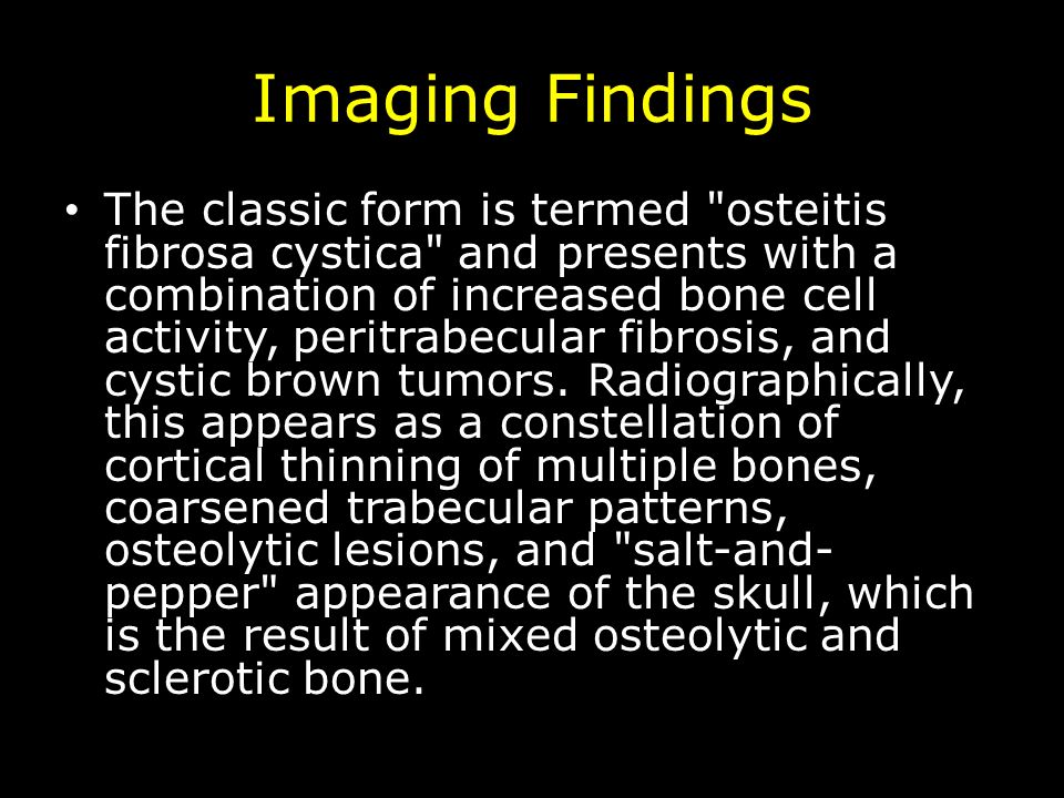Imaging Findings The classic form is termed osteitis fibrosa cystica and presents with a combination of increased bone cell activity, peritrabecular fibrosis, and cystic brown tumors.