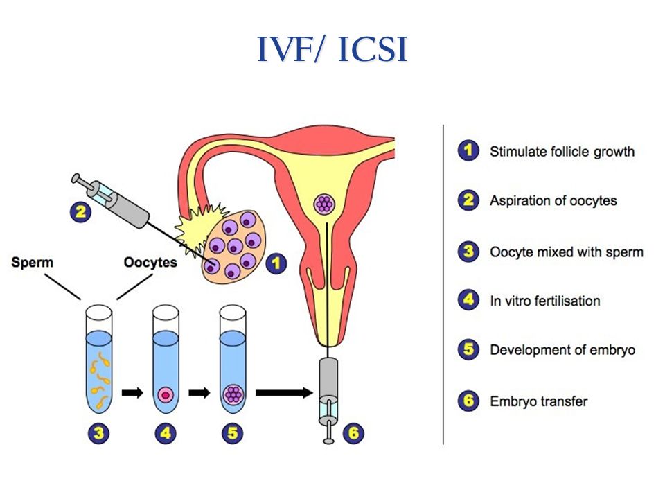 Ivf tests sperm sexual abstinence