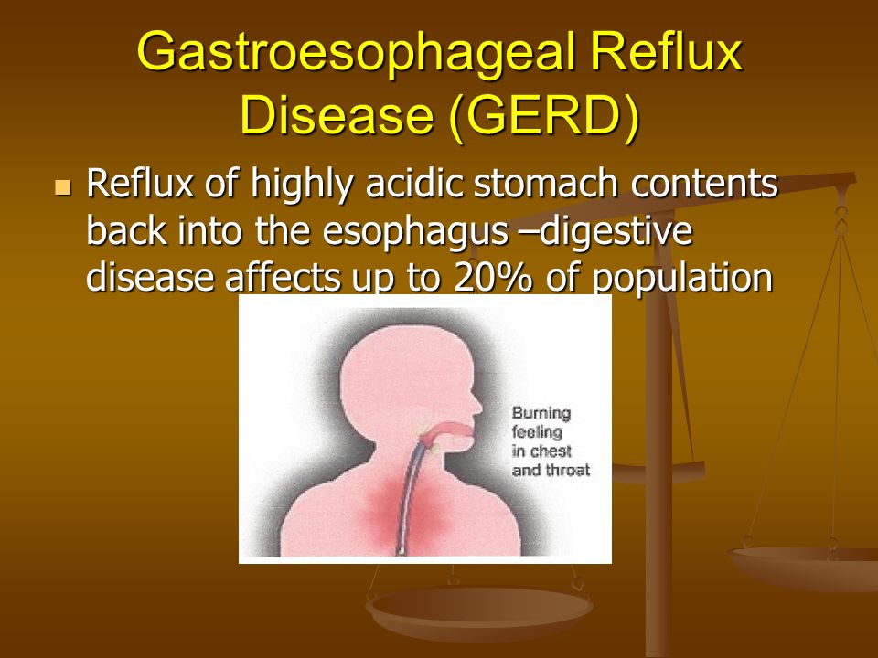 gastro esophageal reflux disease gerd Gastro-esophageal reflux disease without esophagitis 2016 2017 2018 billable/specific code k219 is a billable/specific icd-10-cm code that can be used to indicate a diagnosis for reimbursement purposes. gastro esophageal reflux disease gerd Gastro-esophageal reflux disease without esophagitis 2016 2017 2018 billable/specific code k219 is a billable/specific icd-10-cm code that can be used to indicate a diagnosis for reimbursement purposes.