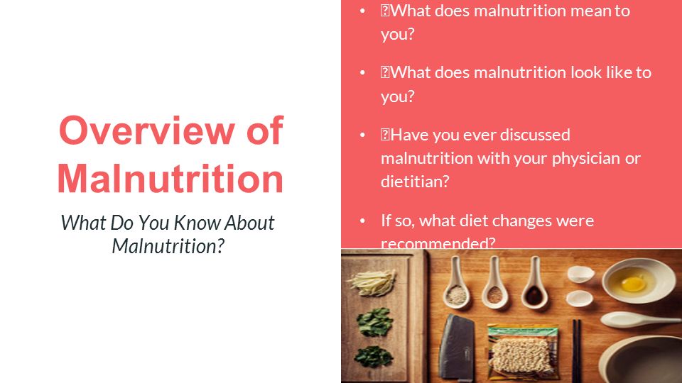 Overview of Malnutrition What Do You Know About Malnutrition.