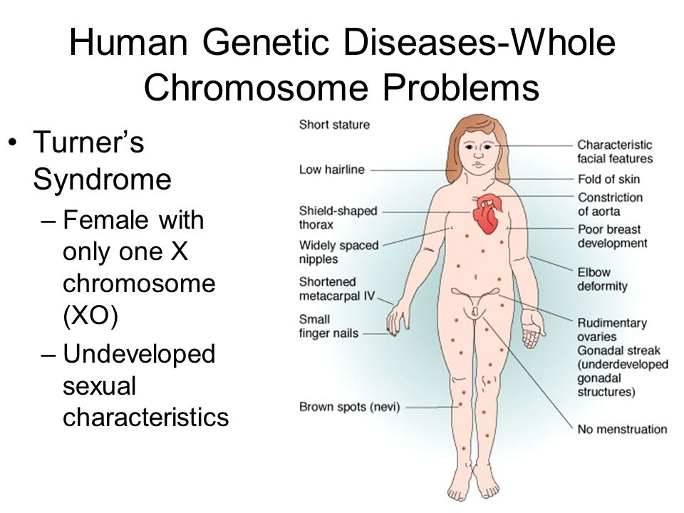 mendelian genetics in humans essay Mendelian genetics in humans essay, nyu creative writing program faculty, phd creative writing sydney university posted on february 8, 2018 by corollary: an essay. mendelian genetics in humans essay Mendelian genetics in humans essay, nyu creative writing program faculty, phd creative writing sydney university posted on february 8, 2018 by corollary: an essay.