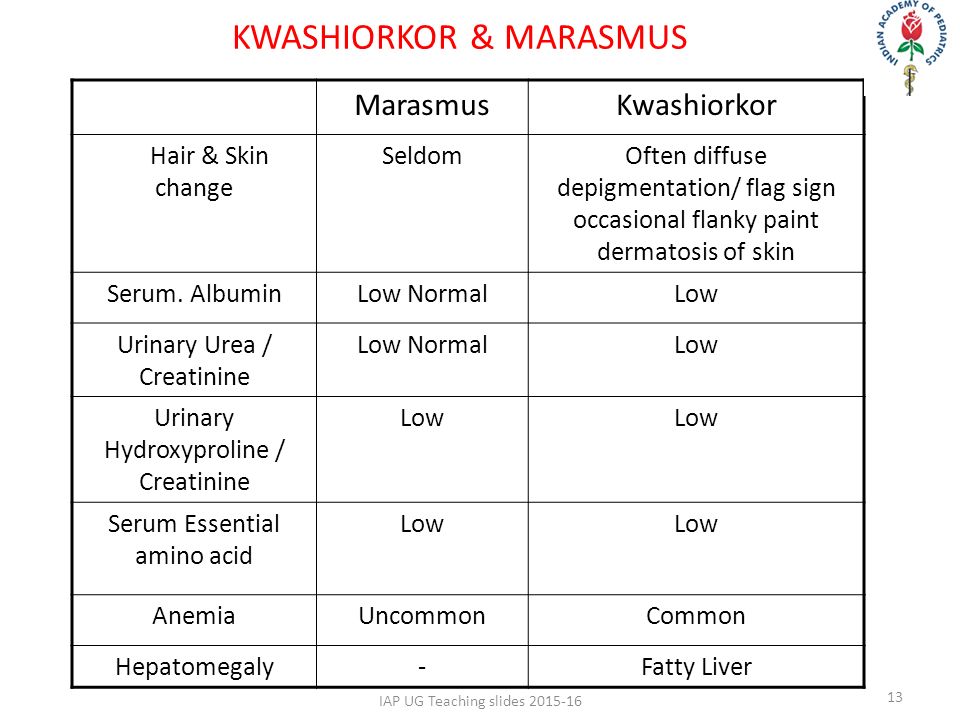 Protein Energy Malnutrition Severe Acute 1iap Ug Marasmuskwashiorkor Hair Skin Change Seldomoften Diffuse Depigmentation Flag Sign Occasional Flanky Paint Dermatosis Of