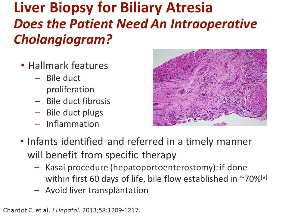 Liver Biopsy for Biliary Atresia Does the Patient Need An Intraoperative Cholangiogram.