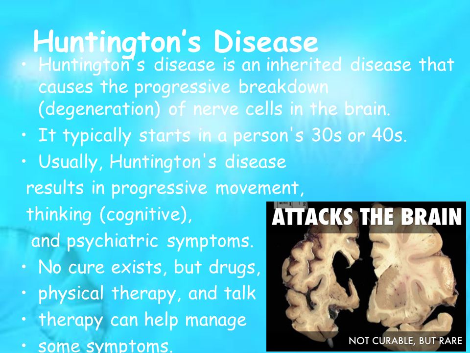 huntintongs disease Huntington's disease (hd) is an inherited disease that causes nerve cells in the brain to waste away it causes disability that gets worse over time. huntintongs disease Huntington's disease (hd) is an inherited disease that causes nerve cells in the brain to waste away it causes disability that gets worse over time.