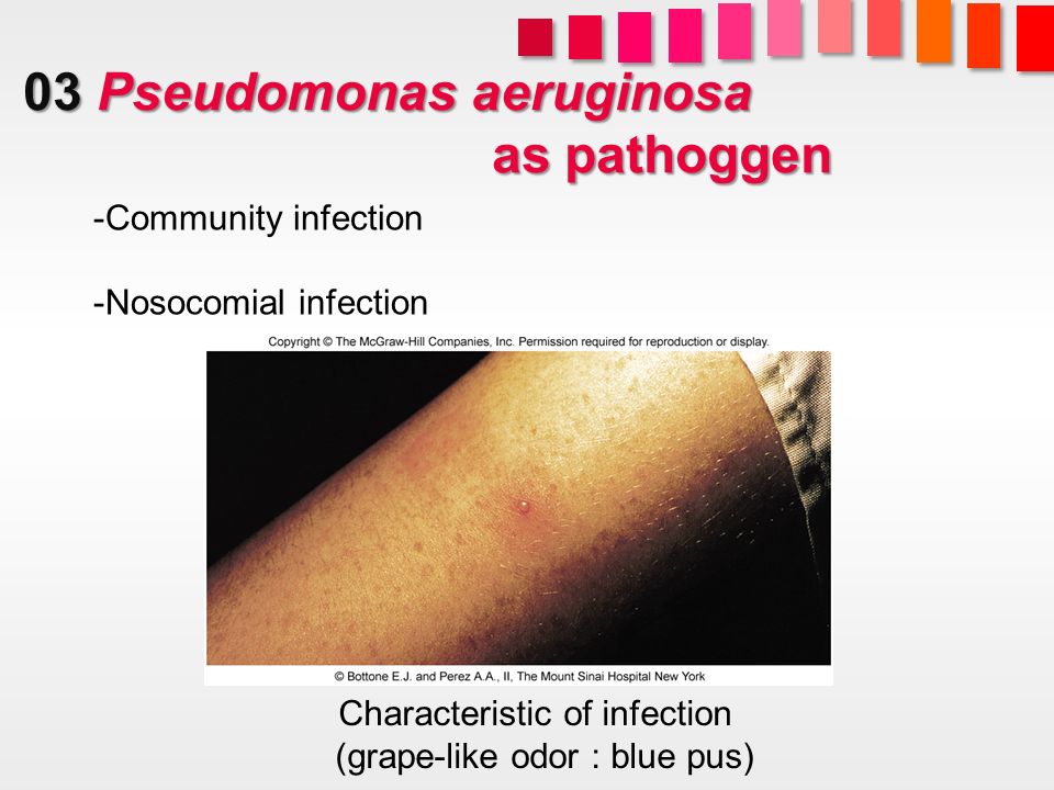 pseudomonas aeruginosa and nosocomial infections Pseudomonas aeruginosa, candida albicans, and device-related nosocomial infections: implications, trends, and potential approaches for control. pseudomonas aeruginosa and nosocomial infections Pseudomonas aeruginosa, candida albicans, and device-related nosocomial infections: implications, trends, and potential approaches for control.