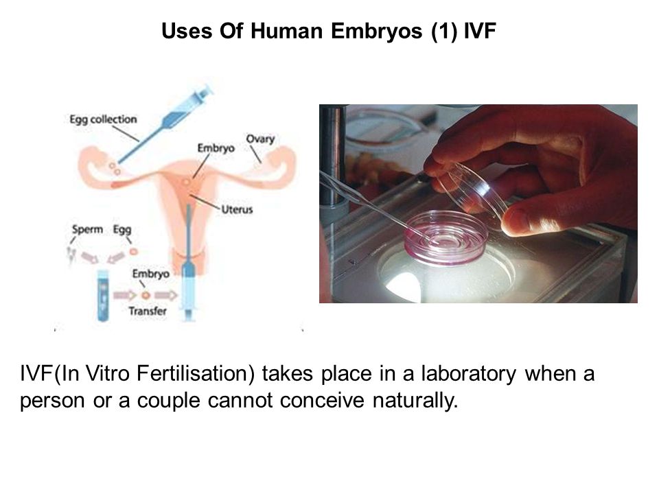 Sex before frozen embryo transfer