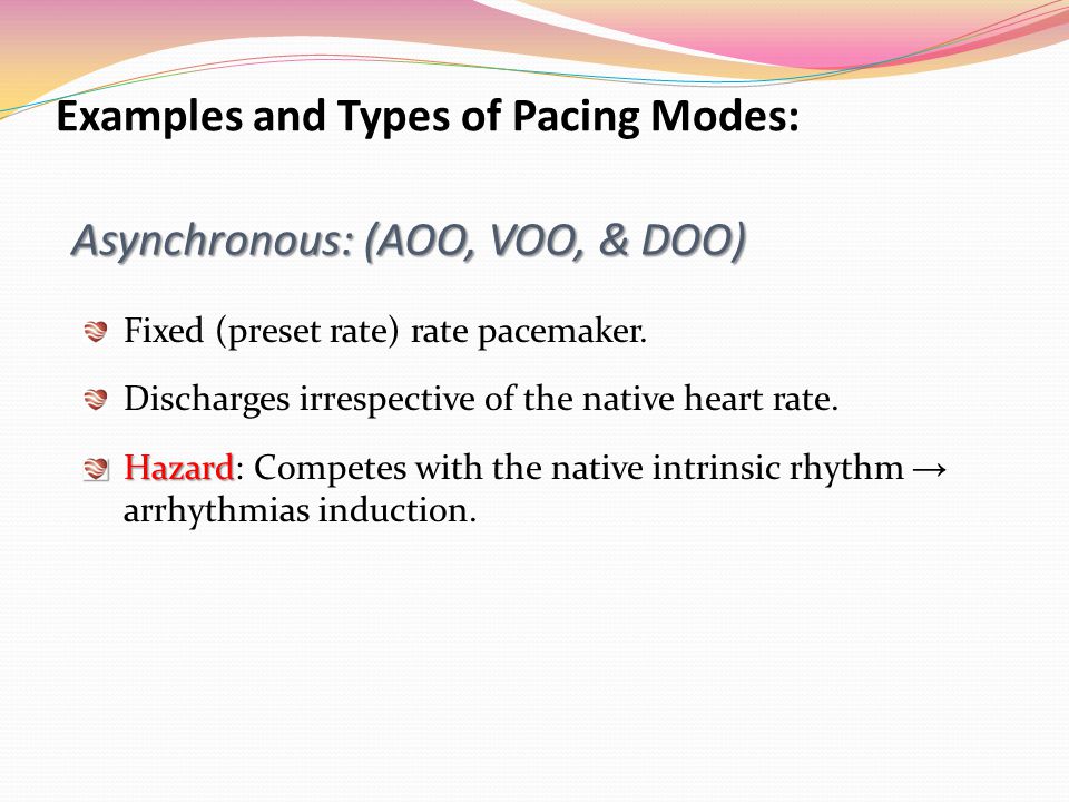 Atrial+Pacemaker+Ekg Atrial Pacing | ECG Guru - Instructor Resources