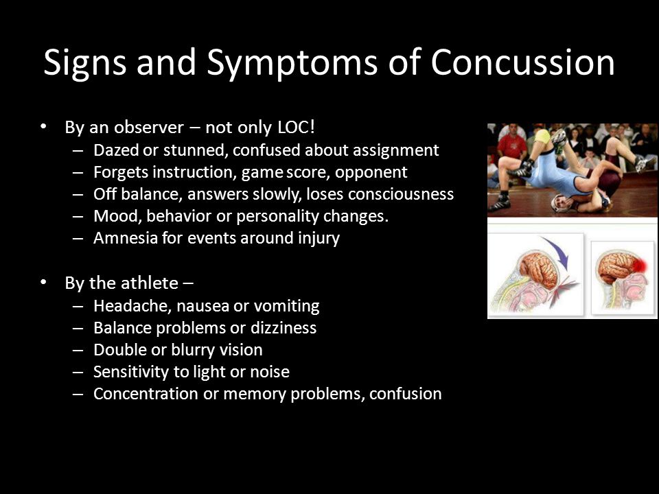 Signs and Symptoms of Concussion By an observer – not only LOC.