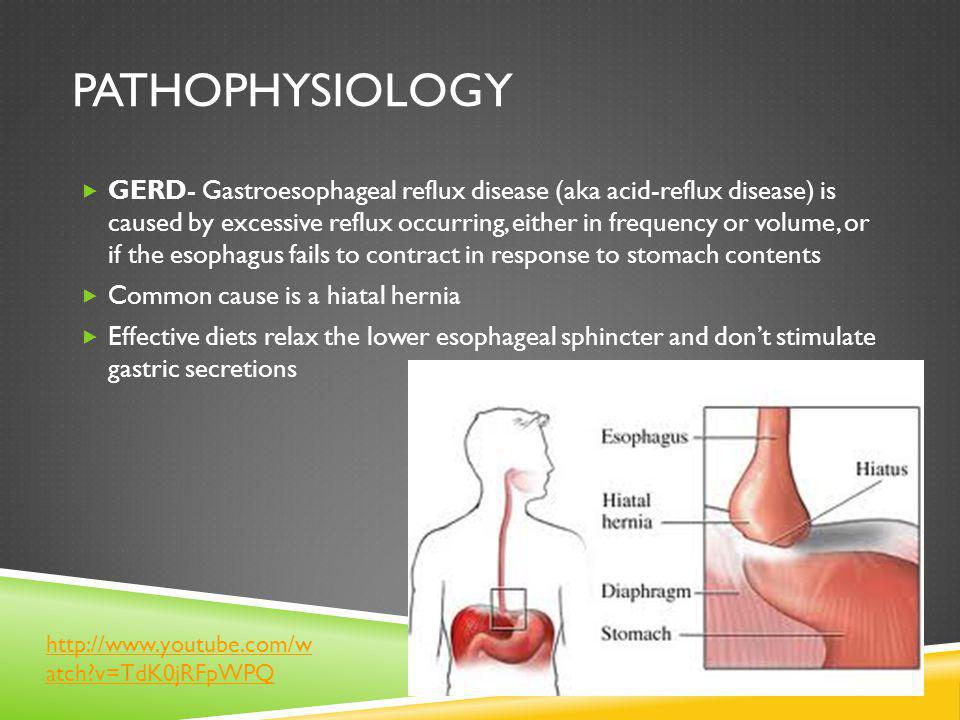 gastroesophageal reflux Heartburn and reflux gastroesophageal reflux disease (gerd) is a digestive disorder that occurs when a weak muscle in the tube (esophagus) connecting your mouth and your stomach doesn't close properly, allowing stomach acid to backflow and irritate the esophagus lining. gastroesophageal reflux Heartburn and reflux gastroesophageal reflux disease (gerd) is a digestive disorder that occurs when a weak muscle in the tube (esophagus) connecting your mouth and your stomach doesn't close properly, allowing stomach acid to backflow and irritate the esophagus lining.