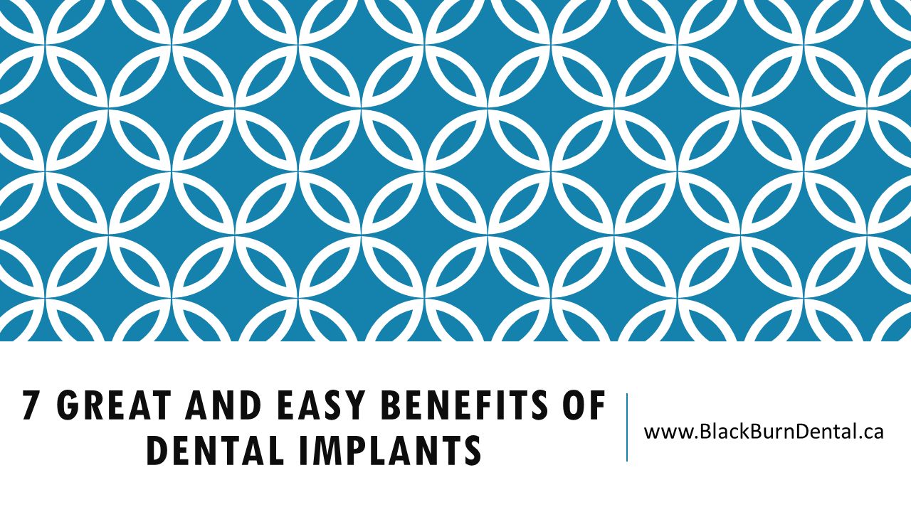 7 GREAT AND EASY BENEFITS OF DENTAL IMPLANTS