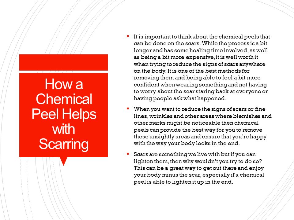 How a Chemical Peel Helps with Scarring  It is important to think about the chemical peels that can be done on the scars.