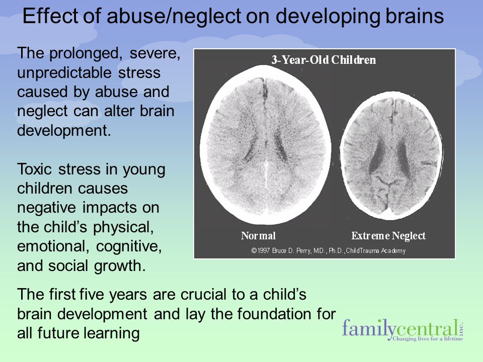 Effect of abuse/neglect on developing brains The prolonged, severe, unpredictable stress caused by abuse and neglect can alter brain development.