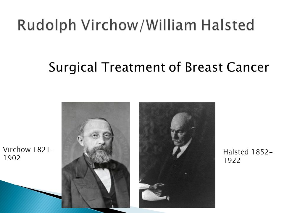 Virchow Halsted Surgical Treatment of Breast Cancer
