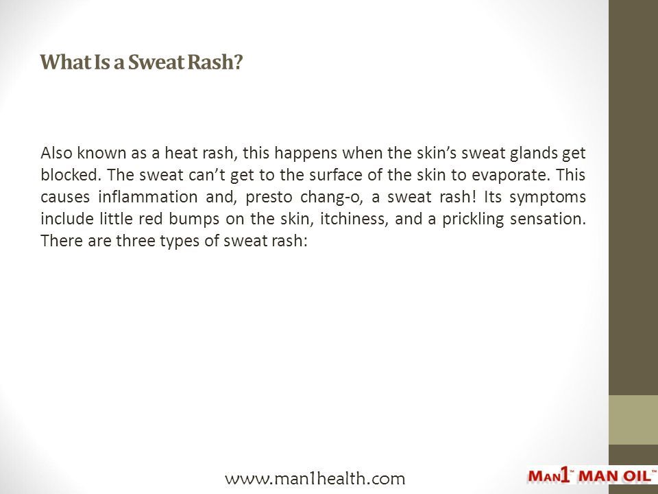How To Treat And Prevent Sweat Rash On The Male Organ Ppt Download how-to-treat-and-prevent-sweat-rash-on-the-male-organ-ppt-download