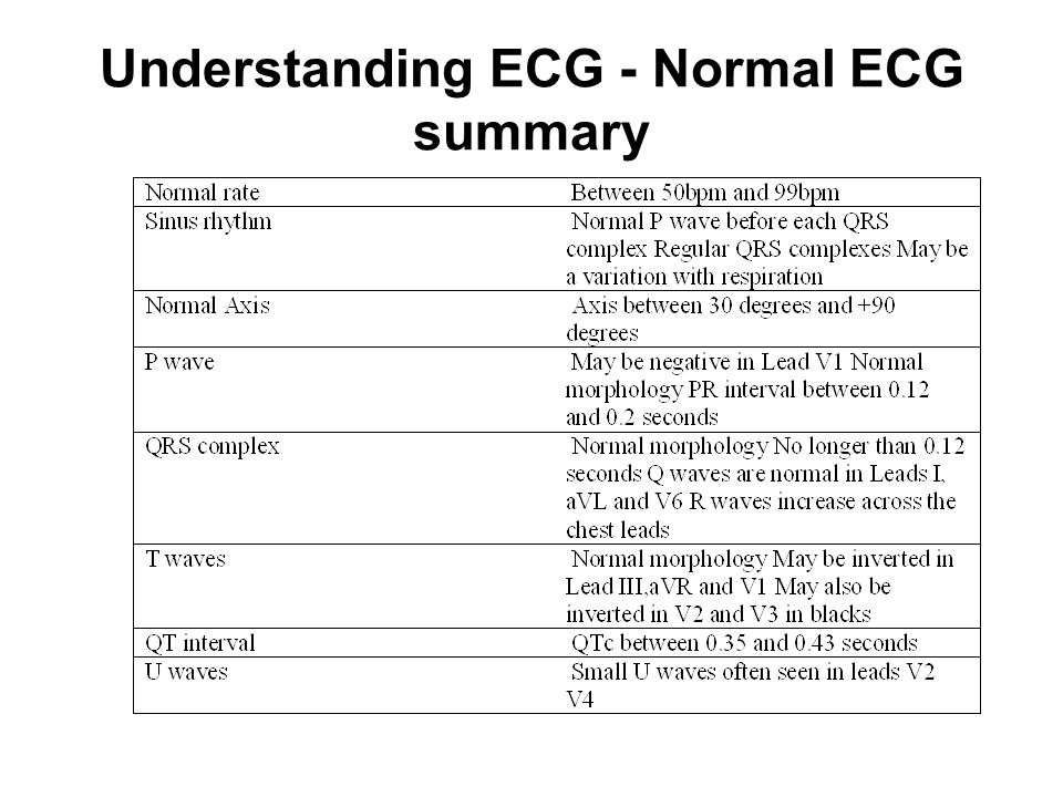 Understanding ECG - Normal ECG summary