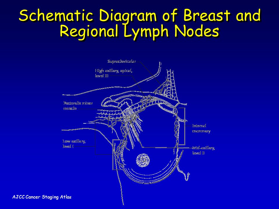 Schematic Diagram of Breast and Regional Lymph Nodes AJCC Cancer Staging Atlas