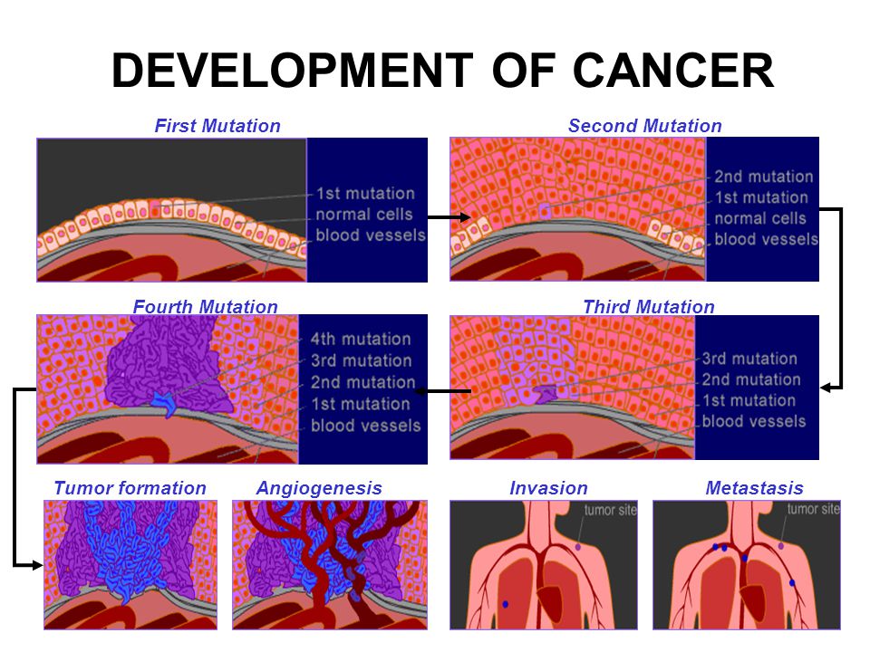 Ангиогенез гистология. Ангиогенез синовиальной оболочки. Cancer Biology. Stages of cancer