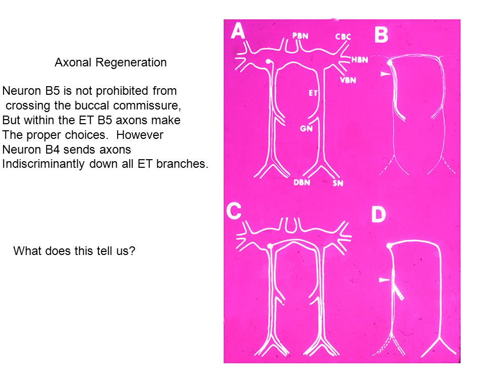 Axonal Regeneration Neuron B5 is not prohibited from crossing the buccal commissure, But within the ET B5 axons make The proper choices.