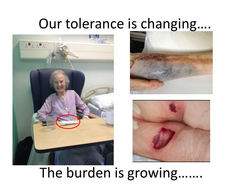 Our tolerance is changing…. The burden is growing…….
