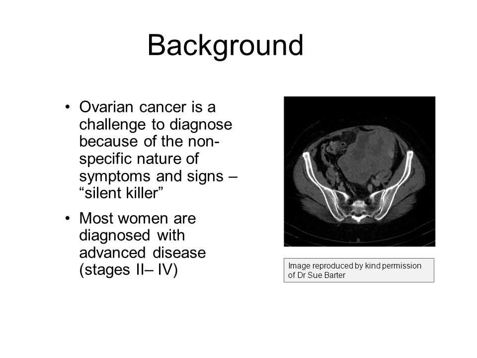 Background Image reproduced by kind permission of Dr Sue Barter Ovarian cancer is a challenge to diagnose because of the non- specific nature of symptoms and signs – silent killer Most women are diagnosed with advanced disease (stages II– IV)